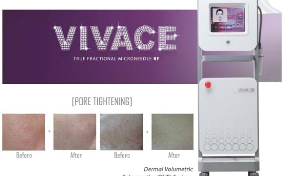 213197756_HKrJv0Al_7250131c391ff38fc6a883cf49c479565f1216c2