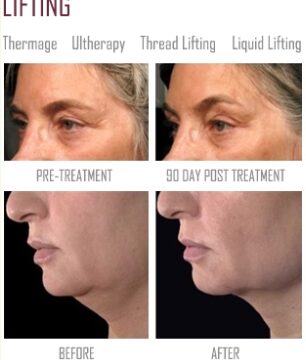 213197756_zGUaZt6R_5017a50915282cbfbb1413af1f46d51342195fc5